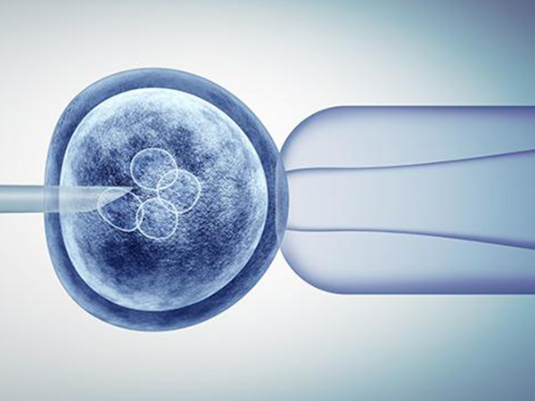ivf 试管婴儿