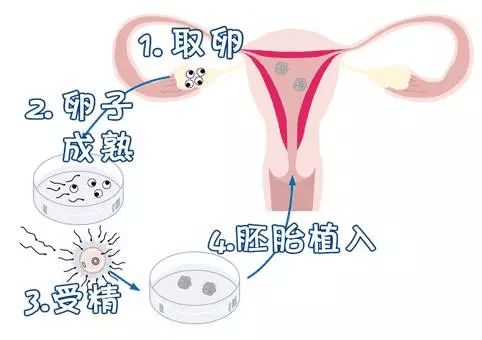 东营是否有捐卵的医院